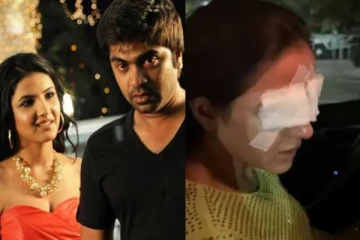 சிம்பு பட நடிகைக்கு என்ன ஆச்சு.. புகைப்படத்தை பார்த்து அதிர்ச்சியடைந்த ரசிகர்கள்