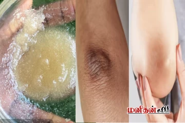 கைமுட்டிகள் மிகவும் கருப்பா இருக்கா? இந்த பொருளை நான்கு முறை போடுங்க