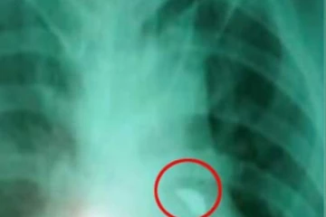 ලංකාවේ වෛද්‍යවරුන් පිරිසක් විසින් සිදුකළ හාස්කමක්..