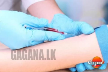 විවාහයට පෙර අනිවාර්යෙන් ලේ පරීක්ෂා කරගන්න සෞඛ්‍ය අංශ බලකරයි