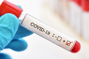 வவுனியாவில் 12 பேருக்கு கோவிட் தொற்று உறுதி