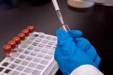 வவுனியாவில் பொலிஸ் உத்தியோகத்தர் உள்ளிட்ட மூவருக்கு கோவிட் - 19 தொற்று உறுதி