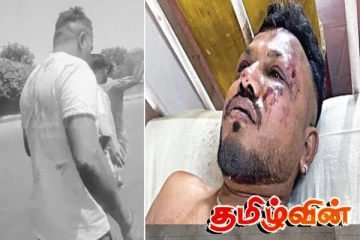 அகமதாபாத் விமான விபத்தில் உயிர் பிழைத்த ஒரே பயணி பகிர்ந்த தகவல்