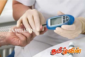 இலங்கையில் நீரிழிவு நோயாளர் எண்ணிக்கை அதிகரிப்பு