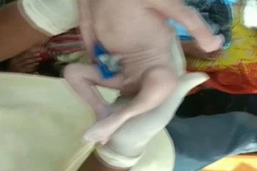 හිසක් නොමැතිව උපත ලද දරුවෙක්.