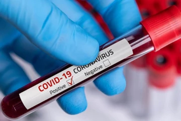 நகர சபை உறுப்பினர் உட்பட 32 பேருக்கு கோவிட் தொற்று