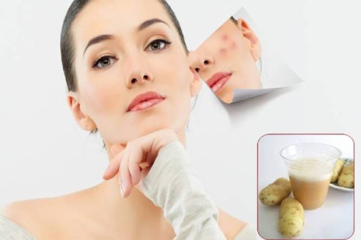 வெயிலால் ஏற்பட்ட கருமையை வெறும் 15 நிமிடங்களில் போக்கணுமா? டாப் 3 ஃபேஸ் பேக்! | How To Remove Tanning From Face In Summer