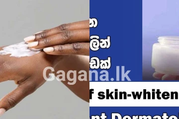 ඔබටත් මේ ලක්ෂණ තිබෙනවා ද..? ෆාමසියෙන් බෙහෙත් ගත්තද..? දැඩි අවධානයෙන් සිටින්න..
