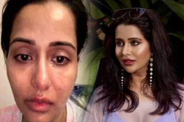 முகம் வீங்கி, கதறி அழுத பிக்பாஸ் ரைசா - புகைப்படம் பார்த்து ஷாக்கான ரசிகர்கள்