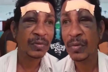 இந்த கட்சிக்கு வாக்களிக்க வேண்டும்... மறுத்த நபர் மீது கொடூர தாக்குதல்!