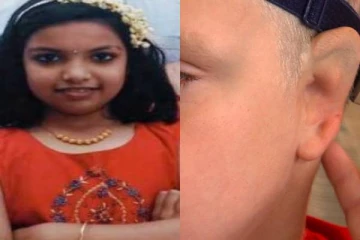 காதுகளில் துவாரம் இல்லாமல் பிறந்த குழந்தை: 10 வருடமாக அவதிப்பட்ட சிறுமியின் சோகக் கதை