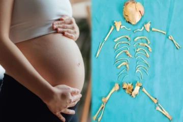 பெண்ணின் வயிற்றில் குழந்தையின் எலும்புக்கூடு.., கருக்கலைப்பு மாத்திரையால் விபரீதம்