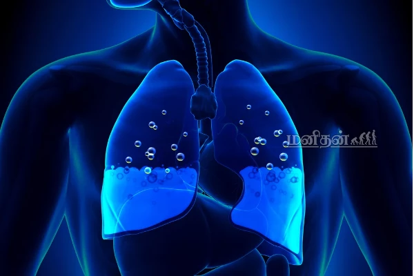 ஈரலில் கெட்ட நீர் தேங்கியிருந்தால் உயிருக்கு ஆபத்து! இந்த  அறிகுறி இருந்தால் உடனே மருத்துவரை நாடுங்கள் | Pulmonary Edema Symptoms In Tamil