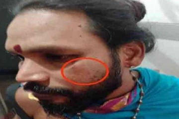 கிளிநொச்சியில் ஐயர் ஒருவரை கடுமையாக தாக்கிய சந்தேக நபர்! பொலிஸார் விசாரணை