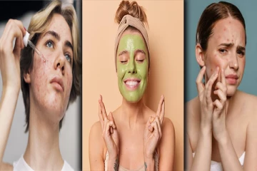 உடனடியாக முகப்பருக்களை நீக்கி நிரந்தர பயன் வேண்டுமா : இலகுவான ஒரே வழி !