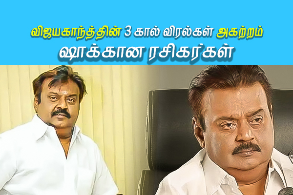 தேமுதிக தலைவர் விஜயகாந்த்தின் 3 கால் விரல்கள் அகற்றம் - ஷாக்கான ரசிகர்கள் - தமிழ்நாடு