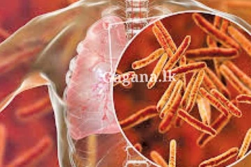 බෝ වන රෝගී තත්ත්වයක වර්ධනයක් - මේ ගැනත් නිරන්තර අවධානයෙන් පසුවන්න.