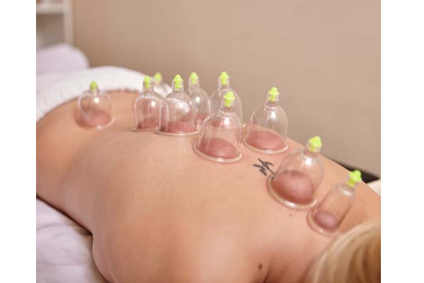 பிரபலமாகி வரும் கப்பிங் சிகிச்சை: இதன் பயன்கள் என்ன? | Cupping Therapy Uses Benefits