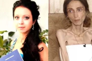 ஹீரோயின் போன்று இருந்த இளம்பெண்! கணவரால் எலும்பும் தோலுமாக மாறிய சோகம்