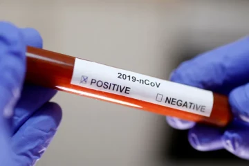 நாட்டில் இன்று பதிவாகிய கோவிட் தொற்றாளர்களின் நிலவரம்