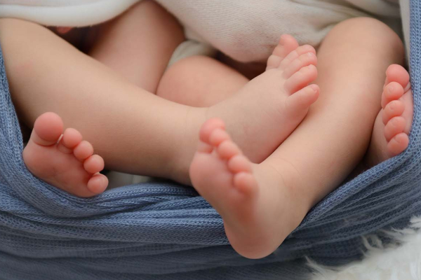 இலங்கையில் ஆச்சரியம் ; வைத்தியர்களை வியப்பில் ஆழ்த்திய இரட்டை குழந்தைகள் | Twin Babies Amaze Doctors In Sri Lanka