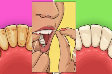 දත් මැලියම් ඉවත් කරන හොඳම ක්‍රම 10ක් මෙන්න.