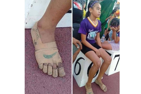 ஒரே ஒரு ஷூவின் புகைப்படம்- மொத்த இணையத்தையும் கலக்கிய 11 வயது சிறுமி! குவியும் பரிசுகள் | 11 Year Old Won Gold Medals Using Shoes Bandages