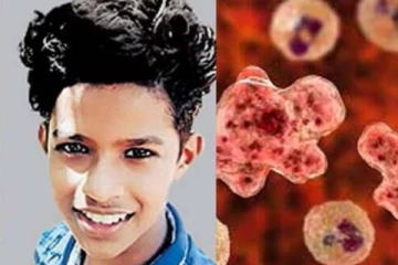 மூளையை உண்ணும் அமீபாவால் சிறுவன் உயிரிழப்பு.. மனிதர்களை எவ்வாறு பாதிக்கும்?