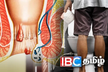 நாளாந்த வாழ்க்கையை பாதிக்கும் ஒரு பொது நோய்