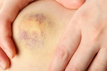 ஆண்களே... இந்த இடத்தில் இப்படி அறிகுறி இருந்தால் புற்றுநோய் தாக்கியிருக்கும் - உடனே இதை செய்யுங்கள்