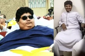 சவுதி மன்னர் செய்த உதவி., 542 கிலோ உடல் எடையை குறைத்த இளைஞர்.!