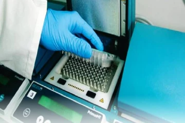 இலங்கையின் அனைத்து பகுதிகளிலும் பி.சி.ஆர் சோதனைகளை மேற்கொள்ள தீர்மானம்