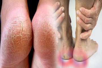 பாத வெடிப்புக்களால் பாதம் அசிங்கமாக உள்ளதா? அப்போ இதை பண்ணுங்க