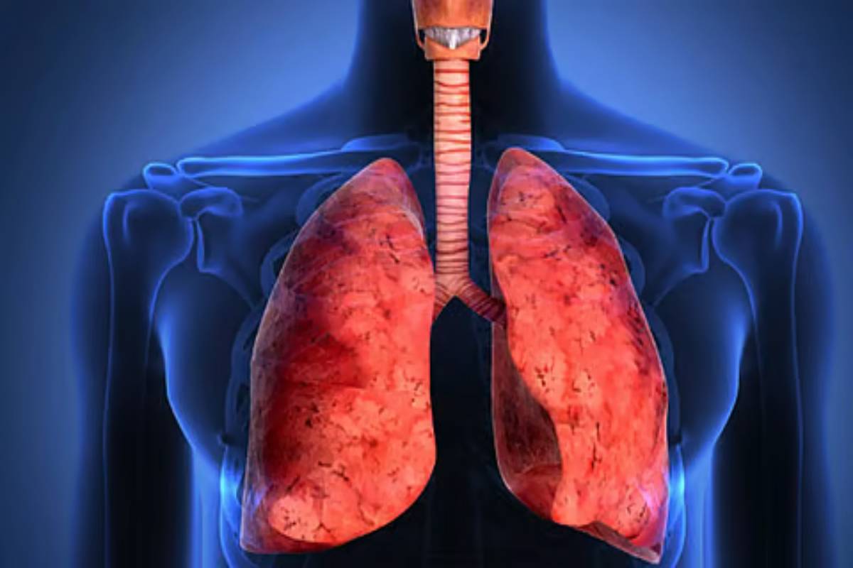 உங்களுக்கு நுரையீரல் புற்றுநோய் இருக்கா? அப்போ இந்த ஆறு அறிகுறிகள் காட்டுமே | Symptoms Of Lung Cancer Lung Cancer