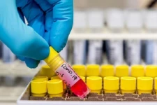 மேல் மாகாணத்திலிருந்து வெளியேறும் இடங்களில் விரைவு என்டிஜன் சோதனை! 13 பேருக்கு தொற்று உறுதி