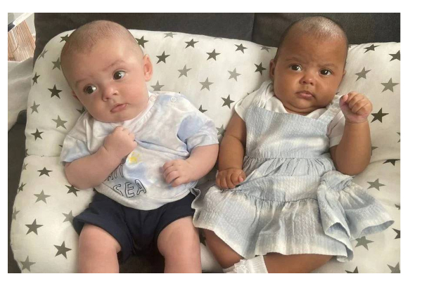 மில்லியனில் ஒருத்தருக்கு தான் இப்படி நடக்கும்! வியக்க வைத்த அபூர்வ இரட்டை குழந்தைகள் | British Nottingham Twins Born With Different Skin