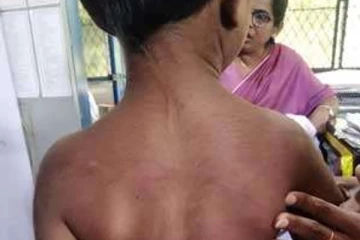 නව හැවිරිදි දැරියකට මිරිස් සහ ගම්මිරිස් මිශ්ර වතුර පොවා ,කකුල් පාගා බඩ ප්රදේශයට දණ හිසෙන් පහර දී කෘෘර ලෙස දසවධ දුන් කුඩම්මා - මෙරටින් ඇසෙන ඇගහිරිවැටෙන පුවත...