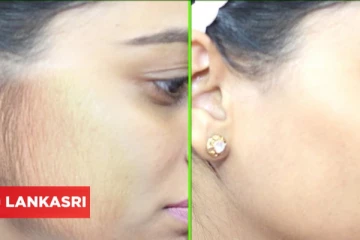 ​முகத்தில் தேவையற்ற முடிகளை நீக்கும் கடலை மாவு! இப்படி பயன்படுத்தி பாருங்க