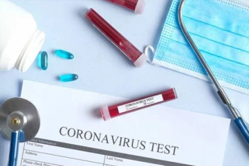 யாழில் நான்கு பொலிஸார் உட்பட மேலும் ஏழு பேருக்கு கோவிட் தொற்று