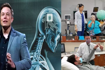 வெற்றிகரமாக மனித மூளையில் சிப் பொருத்திய அமெரிக்காவின் மஸ்கின் நிறுவனம்