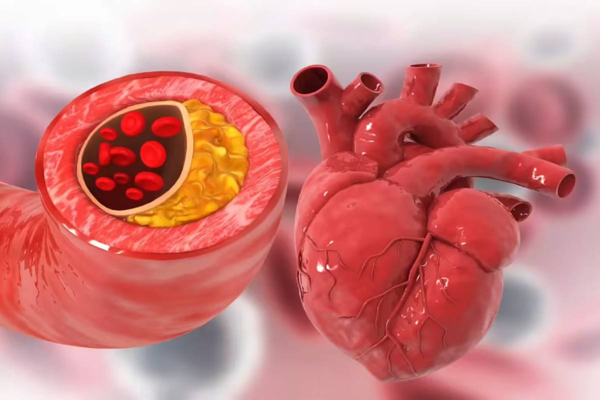 இந்த ஒரு காய் சாப்பிடுங்க - நரம்பில் சிக்கியுள்ள கெட்ட கொழுப்பு கரையும் | Beetroot Controls Cholesterol Improve Heart Health