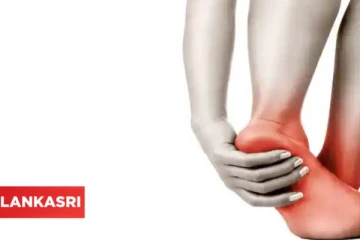 உங்க கால் நெருப்பில் வைத்தது போல எரியுதா? இதனை எப்படி தடுக்கலாம்?