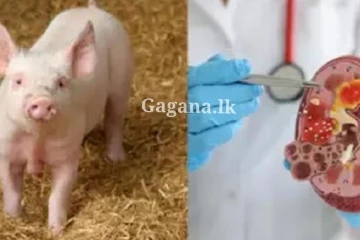 ඌරෙකුගේ සිරුරේ මිනිස් වකුගඩුවක් වර්ධනය කරලා - විද්‍යාඥයින් පිරිසක් විසින් විස්මිත වැඩක්.