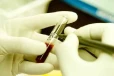 5 குழந்தைகளுக்கு HIV உறுதி - அதிர்ச்சி பின்னணி!