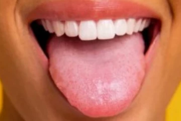 நாவறட்சியை போக்க என்ன செய்ய வேண்டும்?