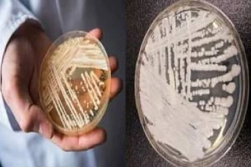 அமெரிக்காவை அலறவிடும் பூஞ்சை தொற்று