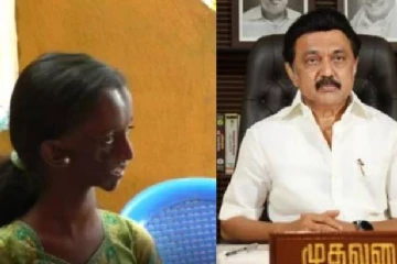 முக தசை சிதைவு நோய்  :  சிறுமி தான்யாவிற்கு 8 மணி நேரம் அறுவை சிகிச்சை