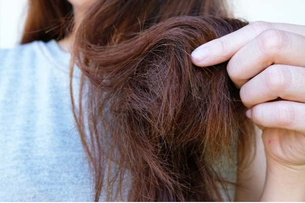 முடி ரொம்ப வறண்டு அசிங்கமா இருக்குதா? இந்த இரண்டு பொருளையும் தலையில் தடவுங்க... அதிசயம் நடக்கும்! | Egg And Oil Hair Masks To Get