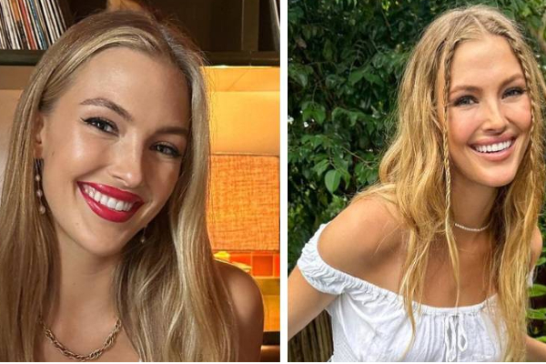 குதிரை சவாரி - 23 வயது பிரபஞ்ச அழகி இறுதி போட்டியாளர் பரிதாப மரணம்! | Miss Universe Finalist Sienna Weir Passed Away