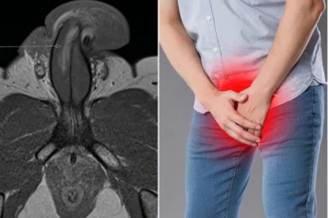 உலகில் எந்த ஆணுக்கும் நேர்ந்திடாத துன்பம்! உறவின் போது பிரித்தானிய நபருக்கு ஏற்பட்ட சொல்லமுடியாத சம்பவம்